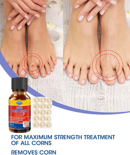 Liquid Corn Remover, Corn Removers for Toes, Fast Acting, Safe Removes Corns Fast Extra Strength for Kids and Adults, 15ml Liquid with 15PCS Cushions 10PCS Swabs (15ML*1)