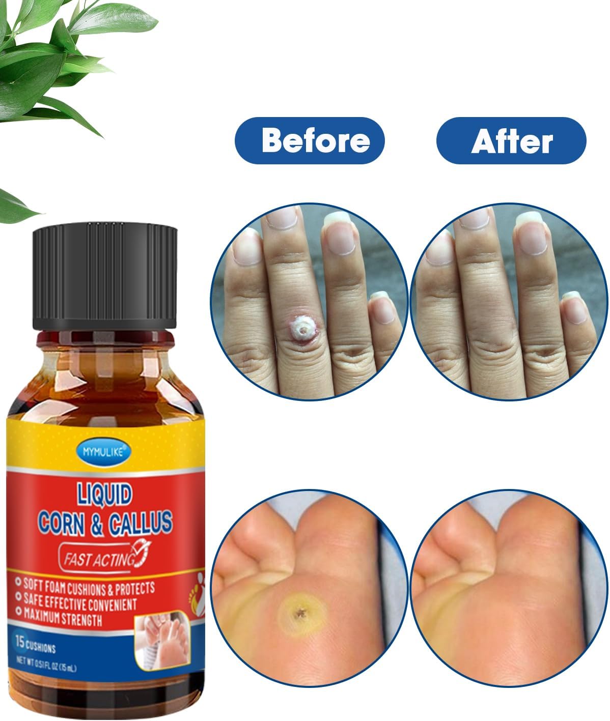 Liquid Corn Remover, Corn Removers for Toes, Fast Acting, Safe Removes Corns Fast Extra Strength for Kids and Adults, 15ml Liquid with 15PCS Cushions 10PCS Swabs (15ML*1)