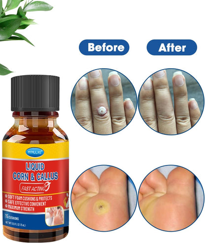 Liquid Corn Remover, Corn Removers for Toes, Fast Acting, Safe Removes Corns Fast Extra Strength for Kids and Adults, 15ml Liquid with 15PCS Cushions 10PCS Swabs (15ML*1)