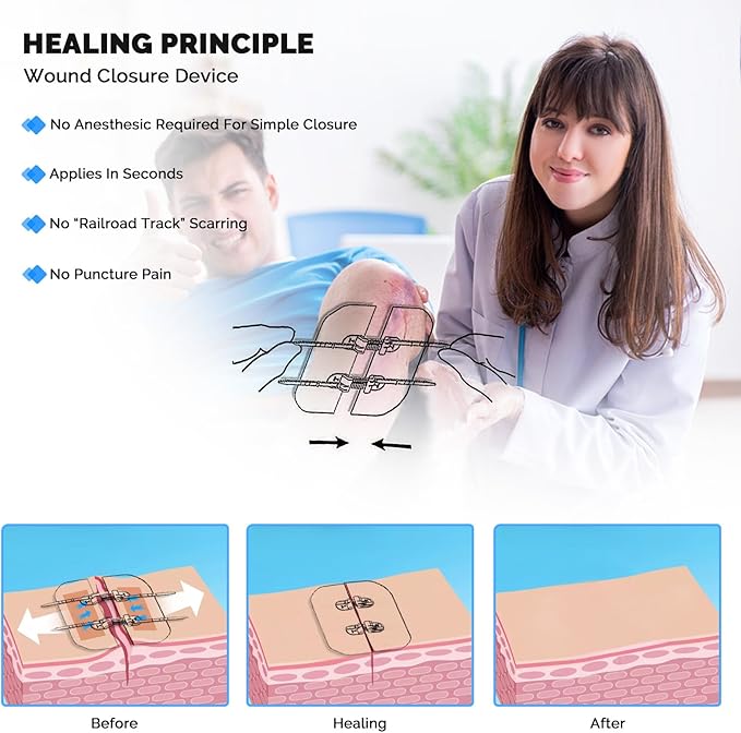 Emergency Wound Closure Strips - 2Pcs Zip Stitch Laceration Closure Kit Closures Repair Wounds Without Stitches - Butterfly Bandages for Wounds