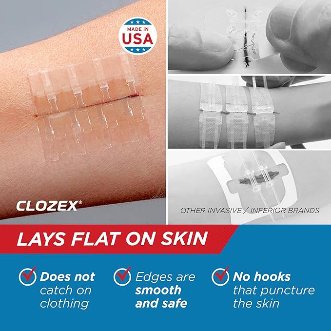 Clozex Emergency Laceration Closure & Kit FSA HSA Eligible Skin Closure Device Treat 5 Wounds Combined Up to 6 3/4" Includes Complete Kit to Clean, Close, & Cover Injuries Without Stitches